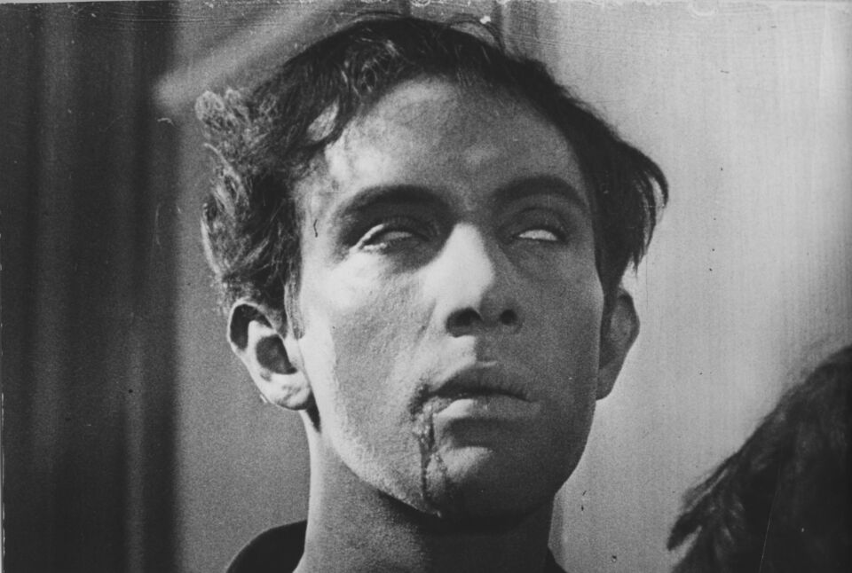 Chien andalou un 5 Bunuel